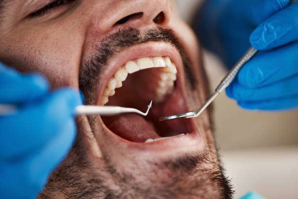Best Urgent Care for Lost Fillings or Crowns in Highlands, CA